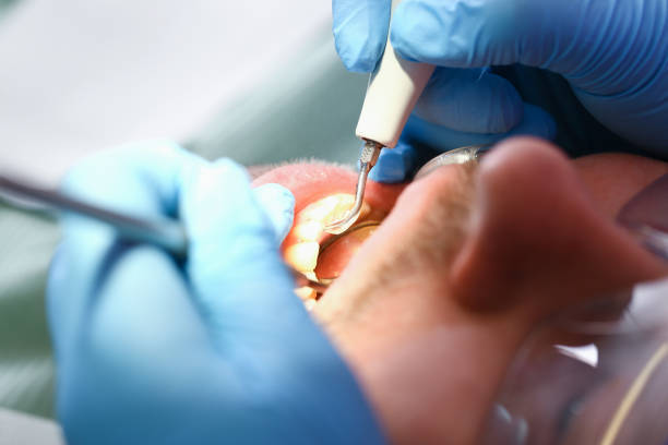 Best Cosmetic Emergency Dentistry in Montgomery, TX