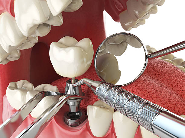 Best After-Hours Dental Trauma Care in Montgomery, TX